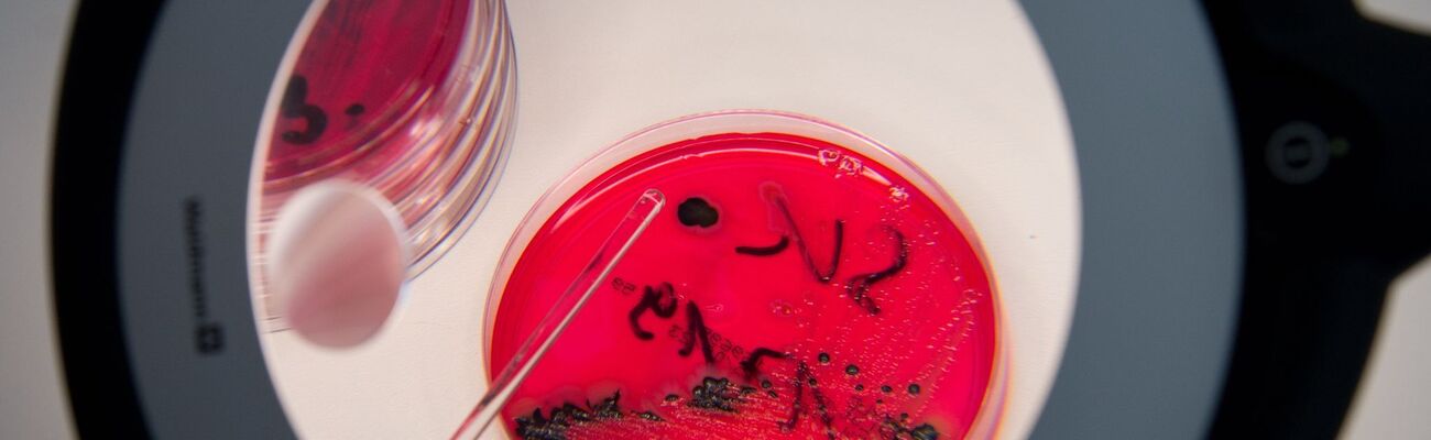 In einem Labor werden Salmonellen in einer Petrischale gezeigt., © Arno Burgi/dpa-Zentralbild/dpa/Symbolbild