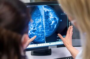 Die Altersobergrenze der kostenlosen Brustkrebsvorsorge wird auf 75 Jahre angehoben., © Hannibal Hanschke/dpa