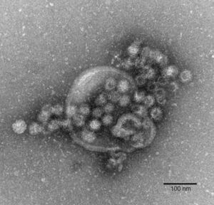 Das hochansteckende Norovirus verursacht einen plötzlich auftretenden, heftigen Brechdurchfall., © Gudrun Holland/RKI/Robert-Koch-Institut/dpa