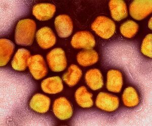 In Deutschland ist zum zweiten Mal die neue Variante des Mpox-Virus nachgewiesen worden, vier Mitglieder einer Familie im Rheinisch-Bergischen Kreis bei Köln sind erkrankt (Archivbild). , © Niaid/Niaid/Planet Pix via ZUMA Press Wire/dpa